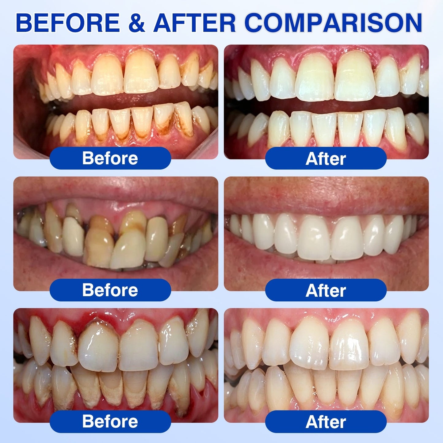 🇬🇧👨‍⚕️🦷🛡️Evolvion® GumRevive Periodontal Repair Gel