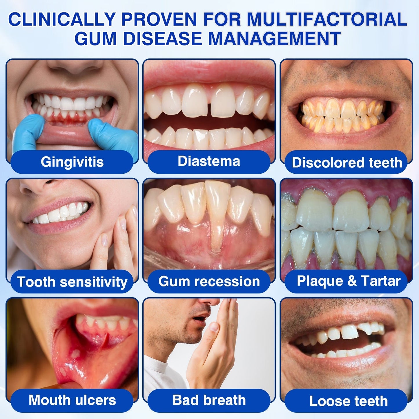 🇬🇧👨‍⚕️🦷🛡️Evolvion® GumRevive Periodontal Repair Gel