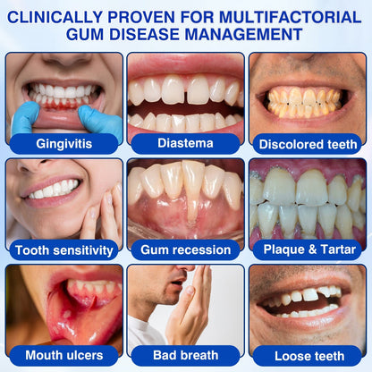 🇬🇧👨‍⚕️🦷🛡️Evolvion® GumRevive Periodontal Repair Gel
