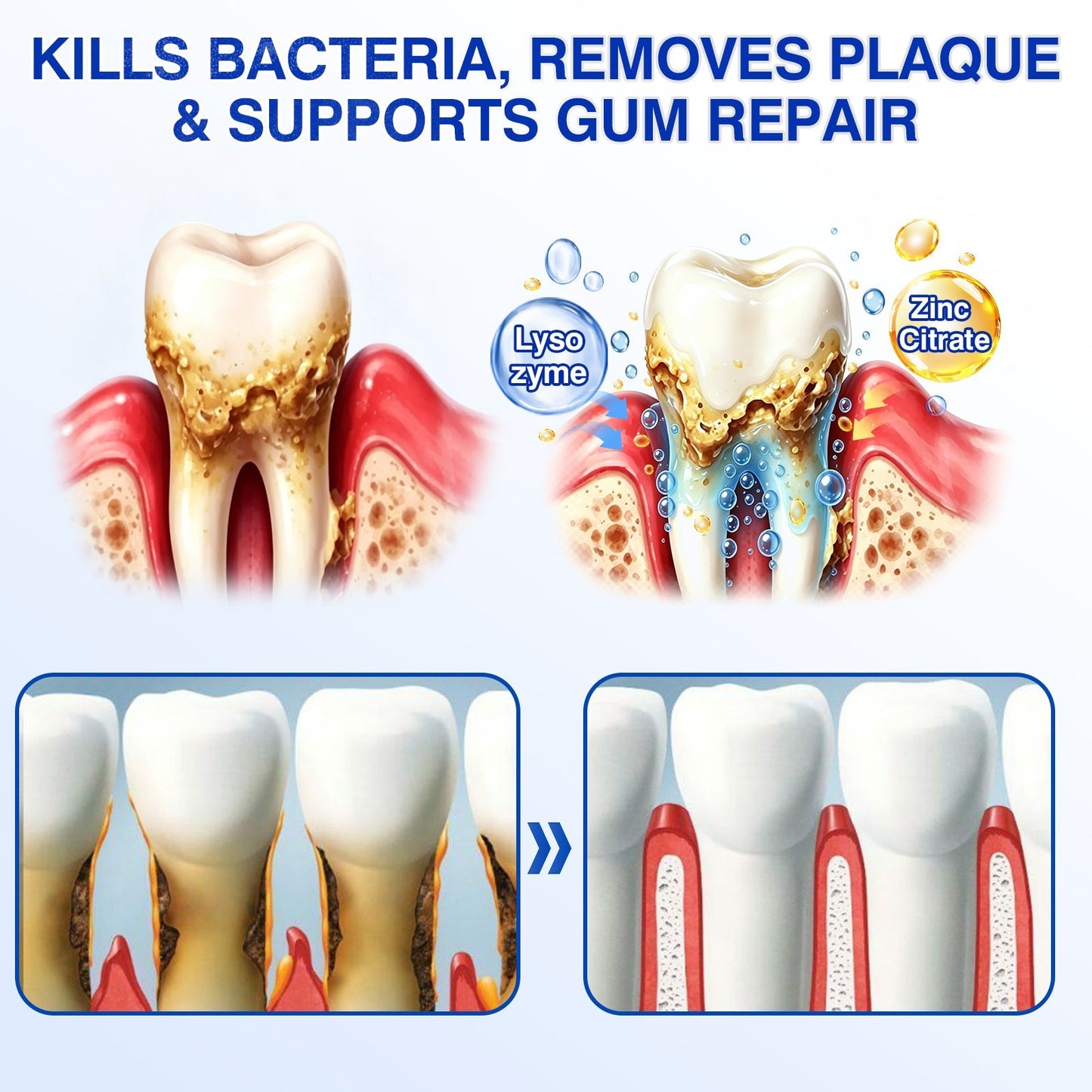 🇬🇧👨‍⚕️🦷🛡️Evolvion® GumRevive Periodontal Repair Gel